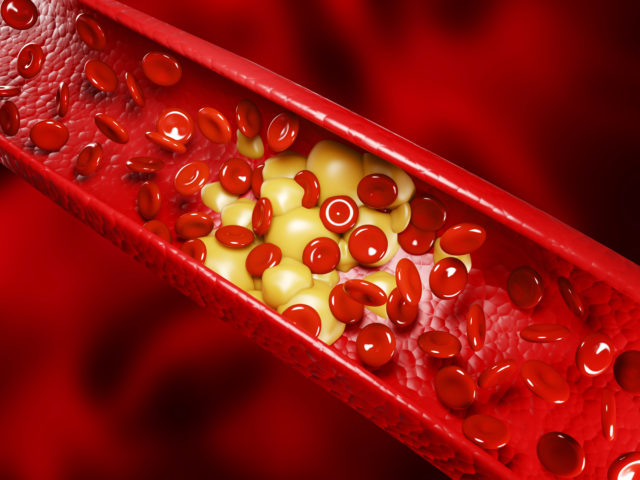 najväčší prirodzení nepriatelia zlého cholesterolu