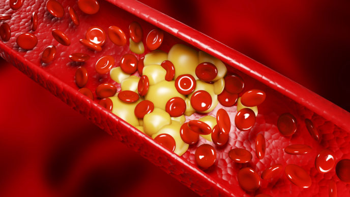 najväčší prirodzení nepriatelia zlého cholesterolu
