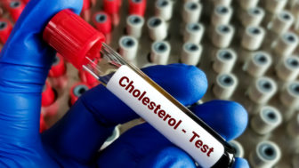 cholesterol