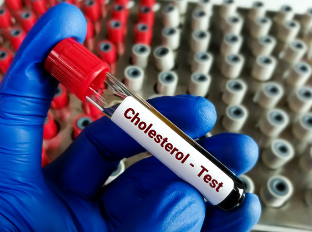 cholesterol