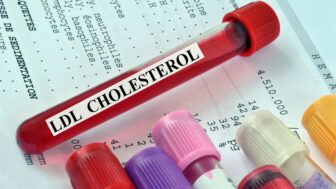 cholesterol