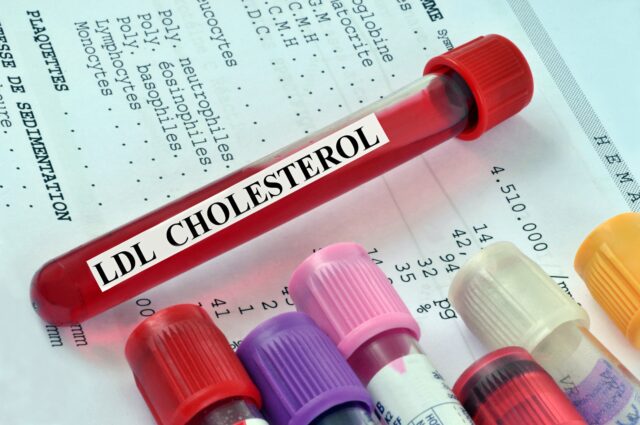 cholesterol