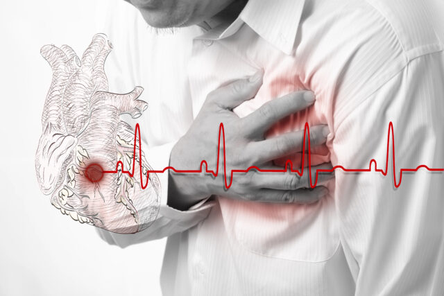infarkt