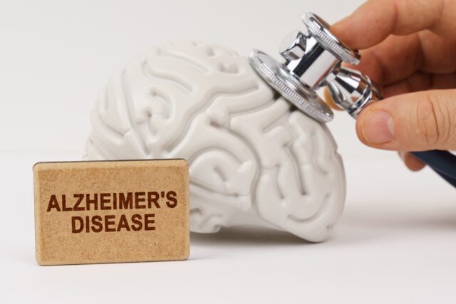 Alzheimer