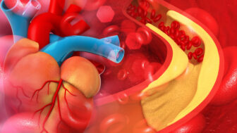 cholesterol