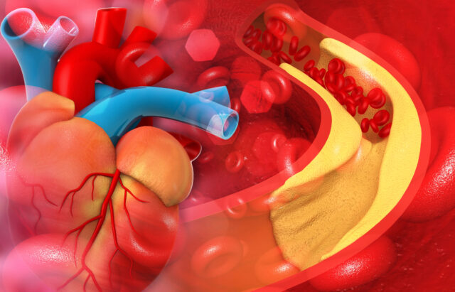 cholesterol