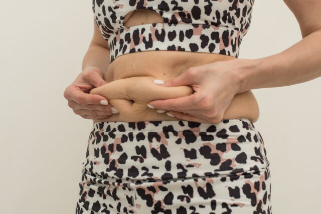 ovisnutá koža po chudnutí