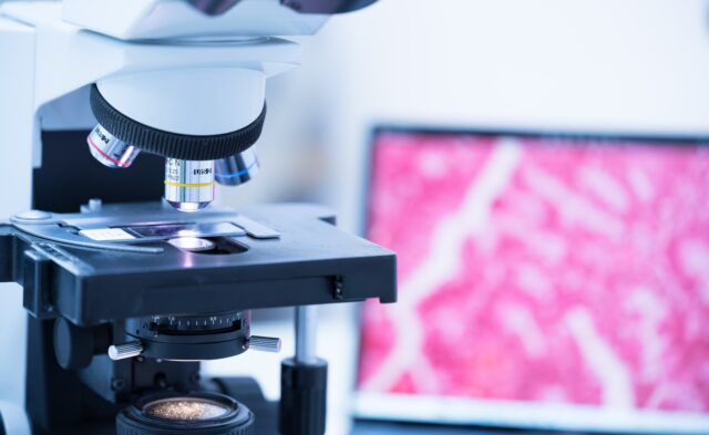 výskum nádorových buniek