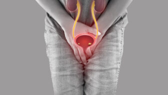 Zápal močových ciest