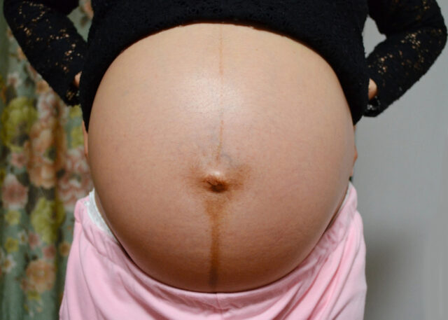 prasknutie plodovej vody