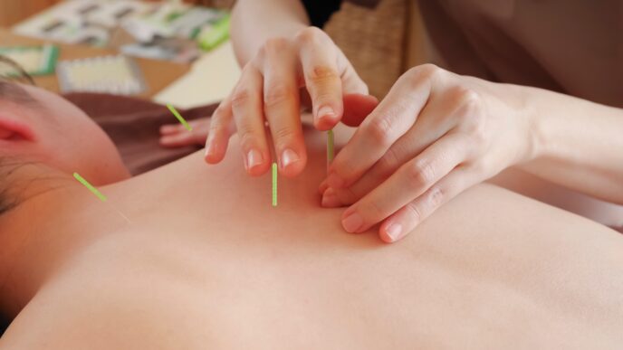 Akupunktúra