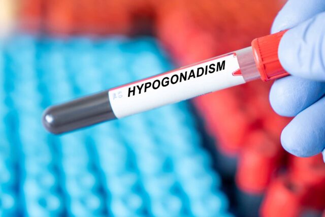 hypogonadizmus