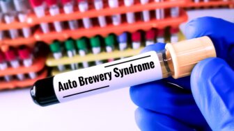 Syndróm auto pivovaru