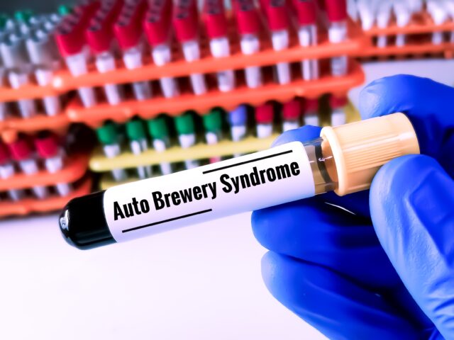 Syndróm auto pivovaru