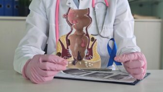 Rakovina konečníka