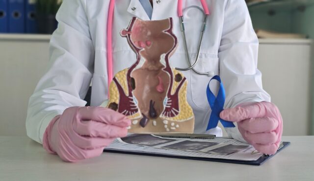 Rakovina konečníka