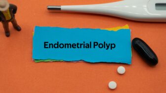 Endometriálny polyp