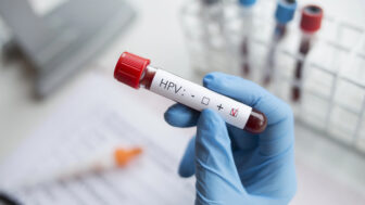 HPV test