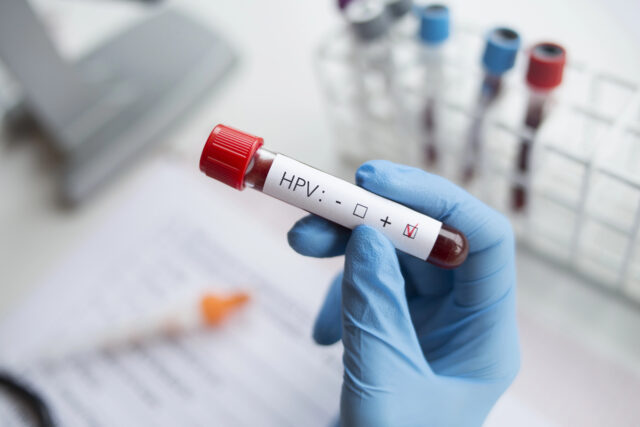 HPV test