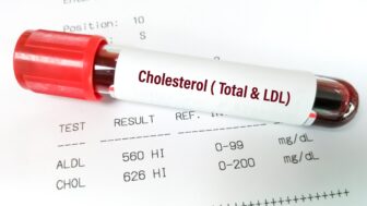 vzorka krvy na cholesterol