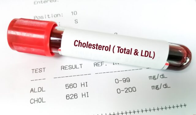vzorka krvy na cholesterol
