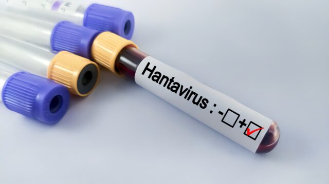 Hantavírus