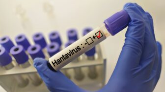hantavírus