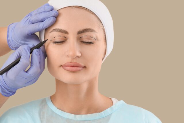 Blefaroplastika