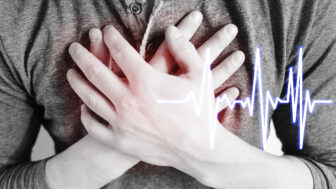 Infarkt