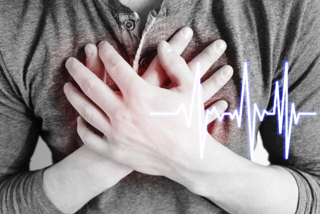 Infarkt