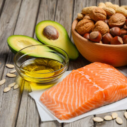 Pri sviatočnom zhone: ktoré potraviny vám pomôžu zbaviť sa stresu!