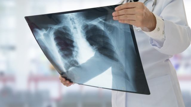 355185_thinkstockphotos 637851338 640x420.jpg