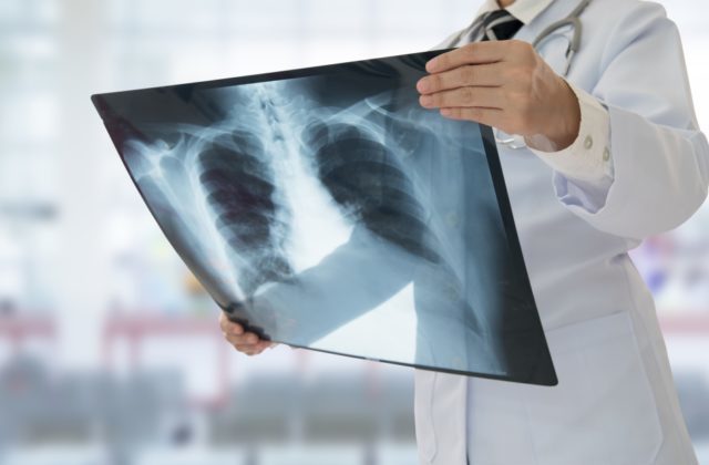 355185_thinkstockphotos 637851338 640x420.jpg