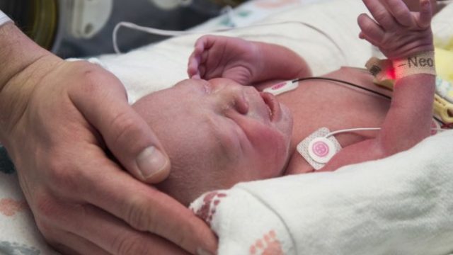 360412_uterus_transplant_birth_26628 045407dd34ff412ea467ca1f50ae6499 676x483.jpg