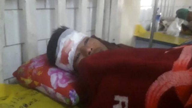 364526_myanmar_protesters_killed_43645 2a2bf742233447478c76781a6ebde924 676x437.jpg