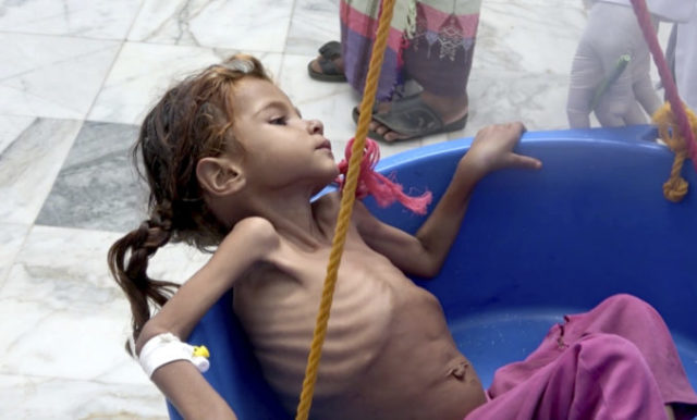 387198_yemen_pocket_of_famine_41091 37770b90069e491ebc57e34515bae99d 676x408.jpg