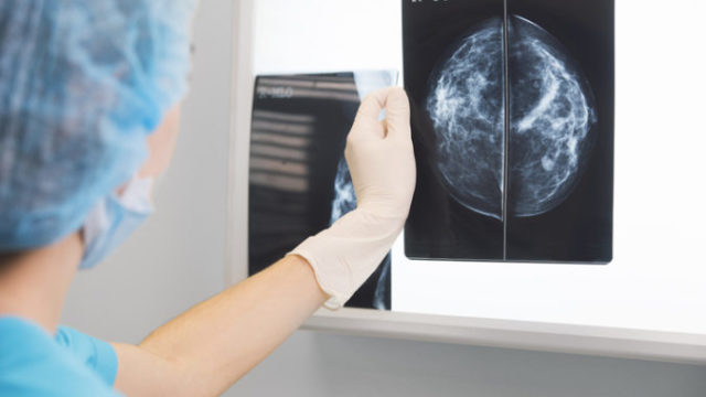 396386_mamogram 676x451.jpg