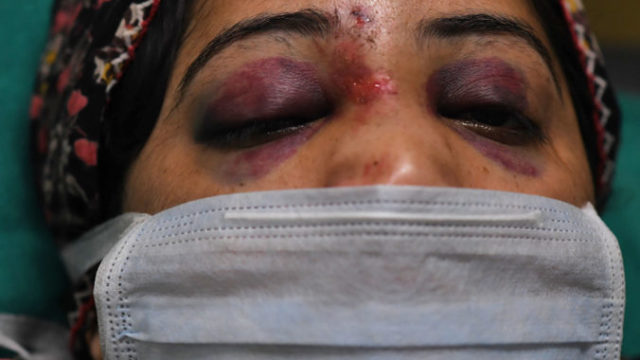 435971_india_violence_90036 f098b6a79b1347eba912dcfcc3f4f48e 1 676x463.jpg