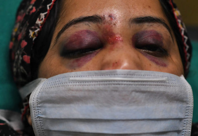 435971_india_violence_90036 f098b6a79b1347eba912dcfcc3f4f48e 1 676x463.jpg