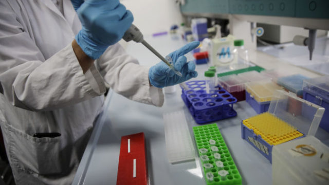 450310_virus_outbreak_italy_rapid_covid 19_saliva_test_60165 ce816a79d238491883d850aeeb52449b 676x451.jpg