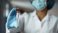 562536_ebola 676x380.jpg