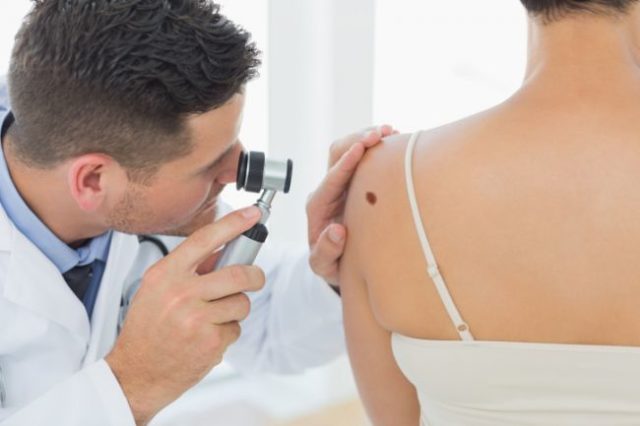 Rakovina kože, melanóm, znamienko, lekár, vyšetrenie, doktor