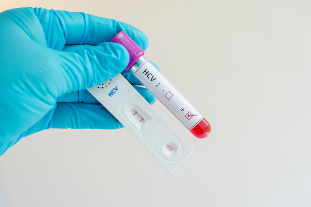 Až 90 percent z vás trpí touto závažnou chorobou, varujú slovenskí lekári