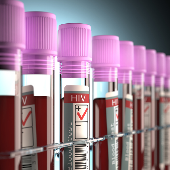 HIV Positive, AIDS