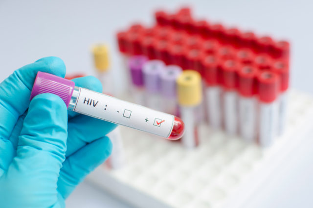 HIV krvný test