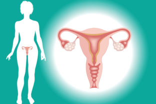 Vaječníky, rakovina vaječníkov, ženské pohlavné orgány