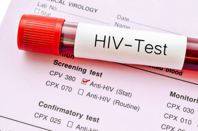 Testy HIV