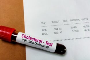 Vysoký cholesterol