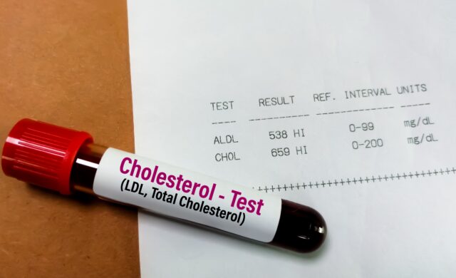Vysoký cholesterol