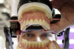 Zuby, protetika, zubný lekár